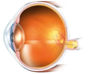 3 Types of Cataract Lenses illustration